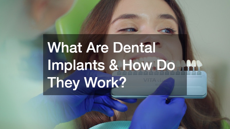 What Are Dental Implants & How Do They Work?