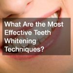 What Are the Most Effective Teeth Whitening Techniques?