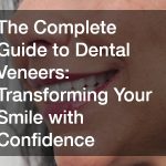 The Complete Guide to Dental Veneers  Transforming Your Smile with Confidence