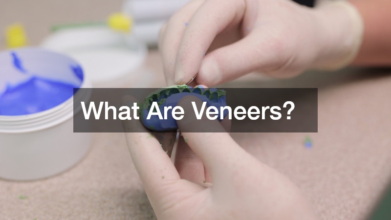 What Are Veneers?